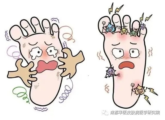 脚上怎么分辨是湿疹还是脚气，一份清晰实用的鉴别指南